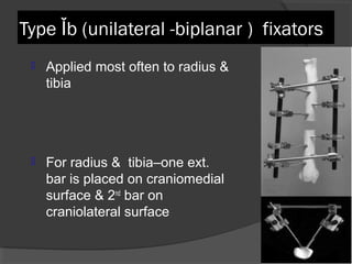 Type Ǐb (unilateral -biplanar )  fixators  Applied most often to radius & tibia  For radius &  tibia–one ext. bar is placed on craniomedial surface & 2 nd  bar on craniolateral surface  