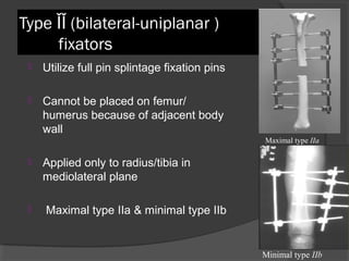 Type ǏǏ (bilateral-uniplanar )   fixators  Utilize full pin splintage fixation pins  Cannot be placed on femur/ humerus because of adjacent body wall Applied only to radius/tibia in mediolateral plane  Maximal type ІІa & minimal type ІІb Maximal type  ІІa Minimal type  ІІb  