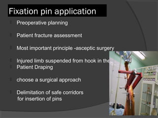 Fixation pin application  Preoperative planning  Patient fracture assessment Most important principle -asceptic surgery  Injured limb suspended from hook in the ceiling  Patient Draping choose a surgical approach Delimitation of safe corridors  for insertion of pins  