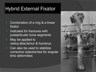 Hybrid External Fixator Combination of a ring & a linear fixator  Indicated for fractures with juxtaarticular bone segments  May be applied to radius,tibia,femur & humerus Can also be used to stabilize corrective osteotomies for angular limb deformities 