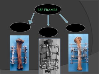 ESF FRAMES   LINEAR CIRCULAR HYBRID  
