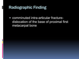 Rolando Fracture | PPTX