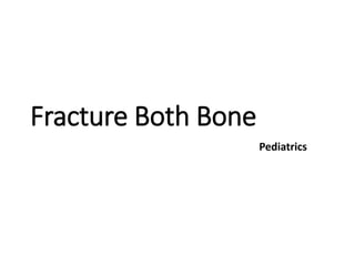 Fracture Both Bone
Pediatrics
 