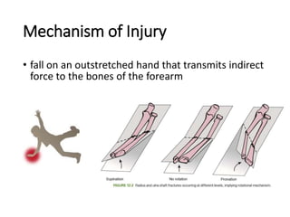 Mechanism of Injury
• fall on an outstretched hand that transmits indirect
force to the bones of the forearm
 