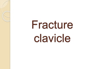 Fracture
clavicle
 