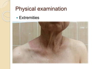 Physical examination
 Extremities
 