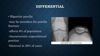DIFFERENTIAL
• Bipartite patella
-may be mistaken for patella
fracture
-affects 8% of population
-characteristic superolateral
position
-bilateral in 50% of cases
 