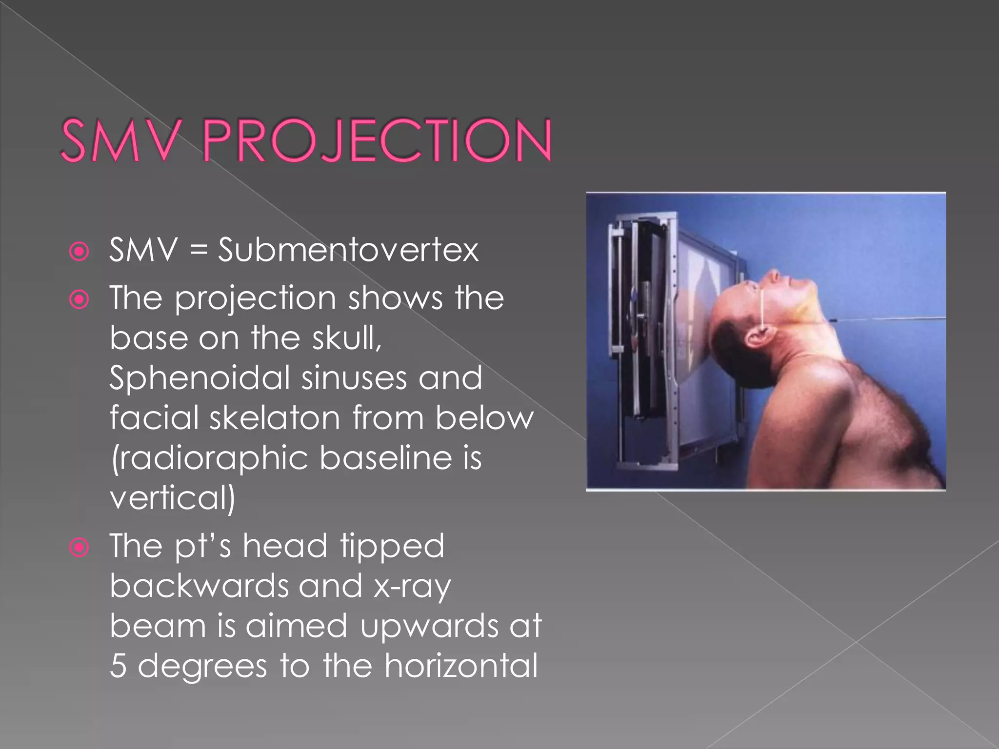  SMV = Submentovertex
 The projection shows the
base on the skull,
Sphenoidal sinuses and
facial skelaton from below
(radioraphic baseline is
vertical)
 The pt’s head tipped
backwards and x-ray
beam is aimed upwards at
5 degrees to the horizontal
 