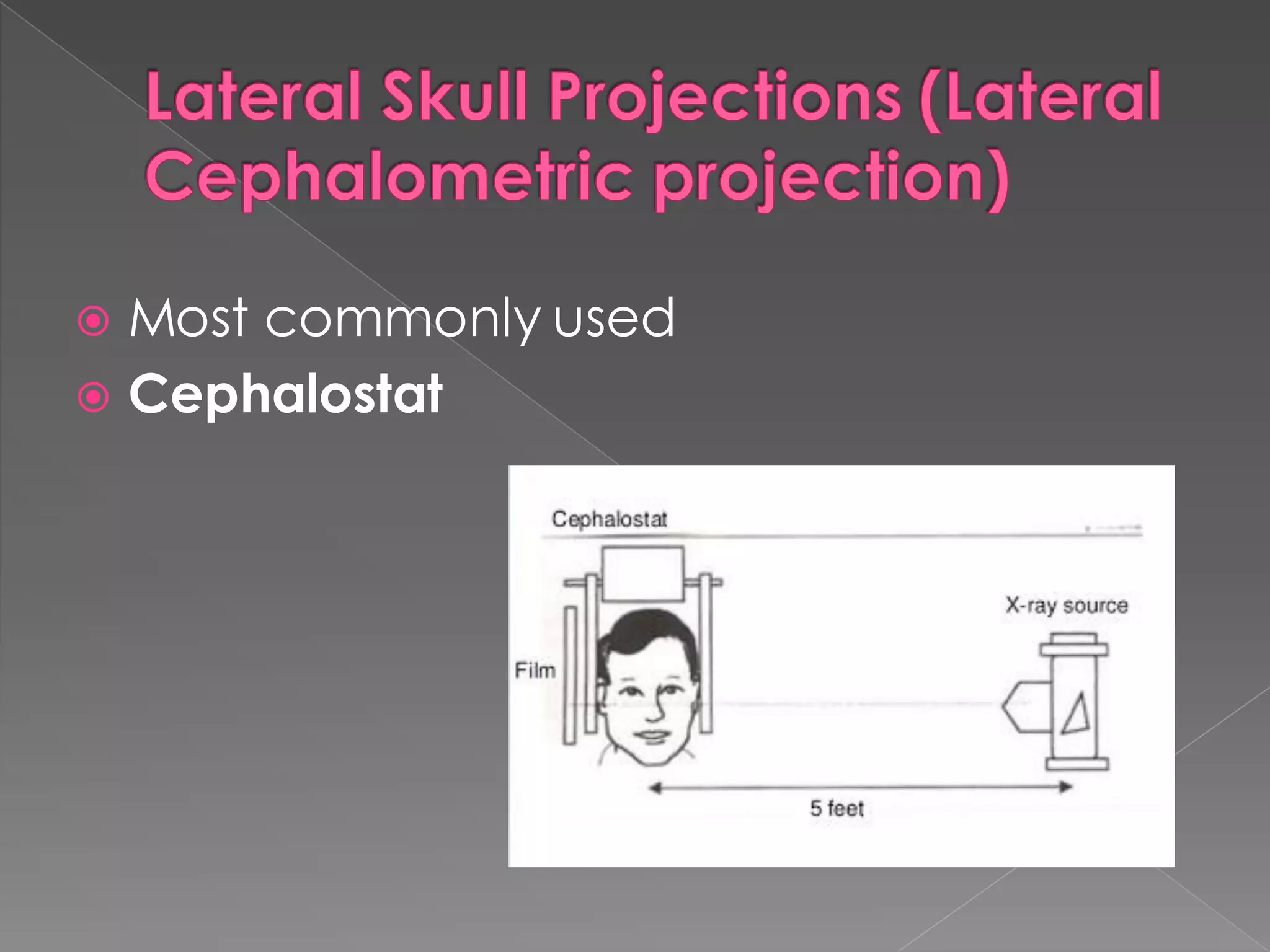  Most commonly used
 Cephalostat
 