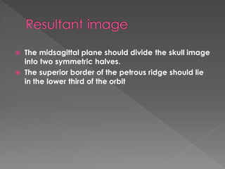 Petrous Ridge Positioning Chart Extra | PDF