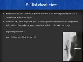 Normal Cheek Projection Extra oral radiographic techniques | PPTX
