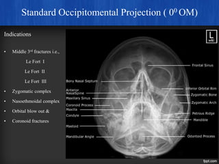 Extra oral radiographic techniques | PPTX