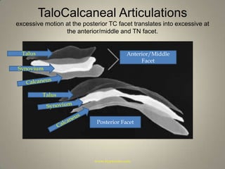 TaloCalcaneal Articulationsexcessive motion at the posterior TC facet translates into excessive at the anterior/middle and TN facet.TalusAnterior/Middle FacetSynoviumCalcaneusTalusSynoviumCalcaneusPosterior Facetwww.hyprocure.com