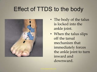 Effect of TTDS to the bodyThe body of the talus is locked into the ankle joint.When the talus slips off the tarsal mechanism that immediately forces the ankle joint to turn inward and downward. www.hyprocure.com