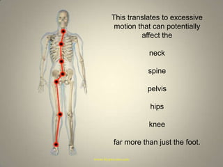 This translates to excessive motion that can potentially affect theneckspinepelvishipskneefar more than just the foot.www.hyprocure.com