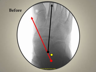 Beforewww.hyprocure.com