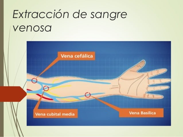 Extraccion de-sangre-venosa-1200769522732978-2