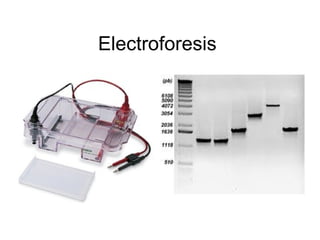 Electroforesis
 