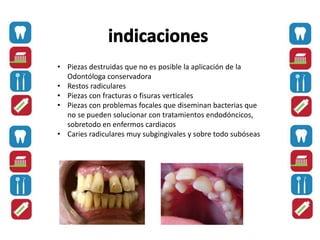 • Piezas destruidas que no es posible la aplicación de la
Odontóloga conservadora
• Restos radiculares
• Piezas con fracturas o fisuras verticales
• Piezas con problemas focales que diseminan bacterias que
no se pueden solucionar con tratamientos endodóncicos,
sobretodo en enfermos cardiacos
• Caries radiculares muy subgingivales y sobre todo subóseas
 