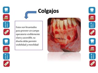 Estos son levantados
para proveeruncampo
operatorio visiblemente
claroy accesible,su
diseño debe permitir
visibilidad y movilidad
 