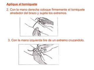 Aplique el torniquete 2. Con la mano derecha coloque firmemente el torniquete alrededor del brazo y sujete los extremos.   3. Con la mano izquierda tire de un extremo cruzandolo. 