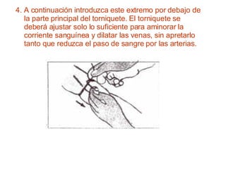4. A continuación introduzca este extremo por debajo de la parte principal del torniquete. El torniquete se deberá ajustar solo lo suficiente para aminorar la corriente sanguínea y dilatar las venas, sin apretarlo tanto que reduzca el paso de sangre por las arterias. 