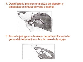 7. Desinfecte la piel con una pieza de algodón y embebida en tintura de yodo o etanol. 8. Toma la jeringa con la mano derecha colocando la yema del dedo índice sobre la base de la aguja. 