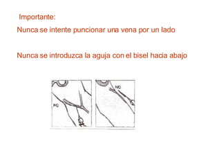 Importante:  Nunca se intente puncionar una vena por un lado Nunca se introduzca la aguja con el bisel hacia abajo 