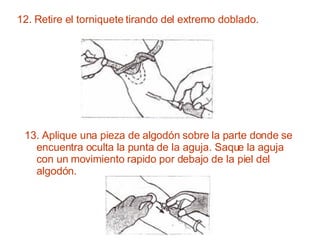 12. Retire el torniquete tirando del extremo doblado.  13. Aplique una pieza de algodón sobre la parte donde se encuentra oculta la punta de la aguja. Saque la aguja con un movimiento rapido por debajo de la piel del algodón.  