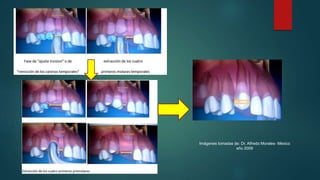 Imágenes tomadas de: Dr. Alfredo Morales- México
año 2009
 