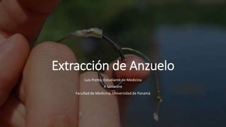 Extracción de Anzuelo
Luis Pretto, Estudiante de Medicina
X Semestre
Facultad de Medicina, Universidad de Panamá
 