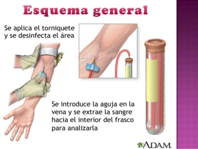Extraccion de sangre