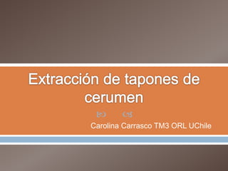  
Carolina Carrasco TM3 ORL UChile
 