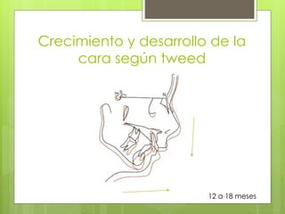 Crecimiento y desarrollo de la
cara según tweed
12 a 18 meses
 