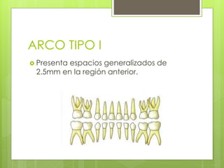 ARCO TIPO I
 Presenta espacios generalizados de
2.5mm en la región anterior.
 