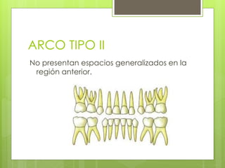 ARCO TIPO II
No presentan espacios generalizados en la
región anterior.
 