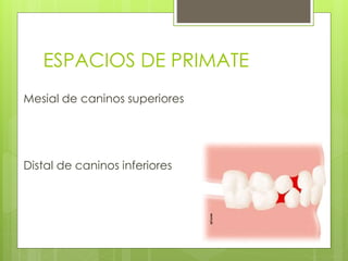 ESPACIOS DE PRIMATE
Mesial de caninos superiores
Distal de caninos inferiores
 