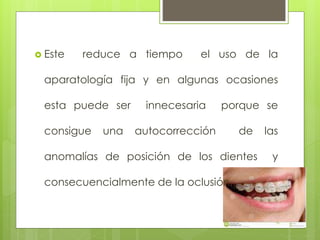  Este reduce a tiempo el uso de la
aparatología fija y en algunas ocasiones
esta puede ser innecesaria porque se
consigue una autocorrección de las
anomalías de posición de los dientes y
consecuencialmente de la oclusión..
 