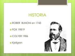 HISTORIA
 ROBER BUNONI en 1743
 FOX 19819
 COLYER 1986
 Kjellgren
 