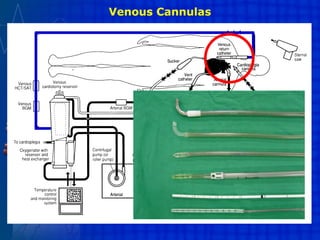 Venous Cannulas
 