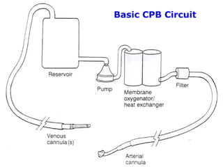 Basic CPB Circuit
 