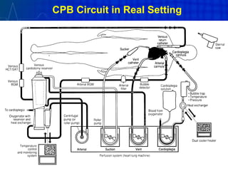 CPB Circuit in Real Setting
 