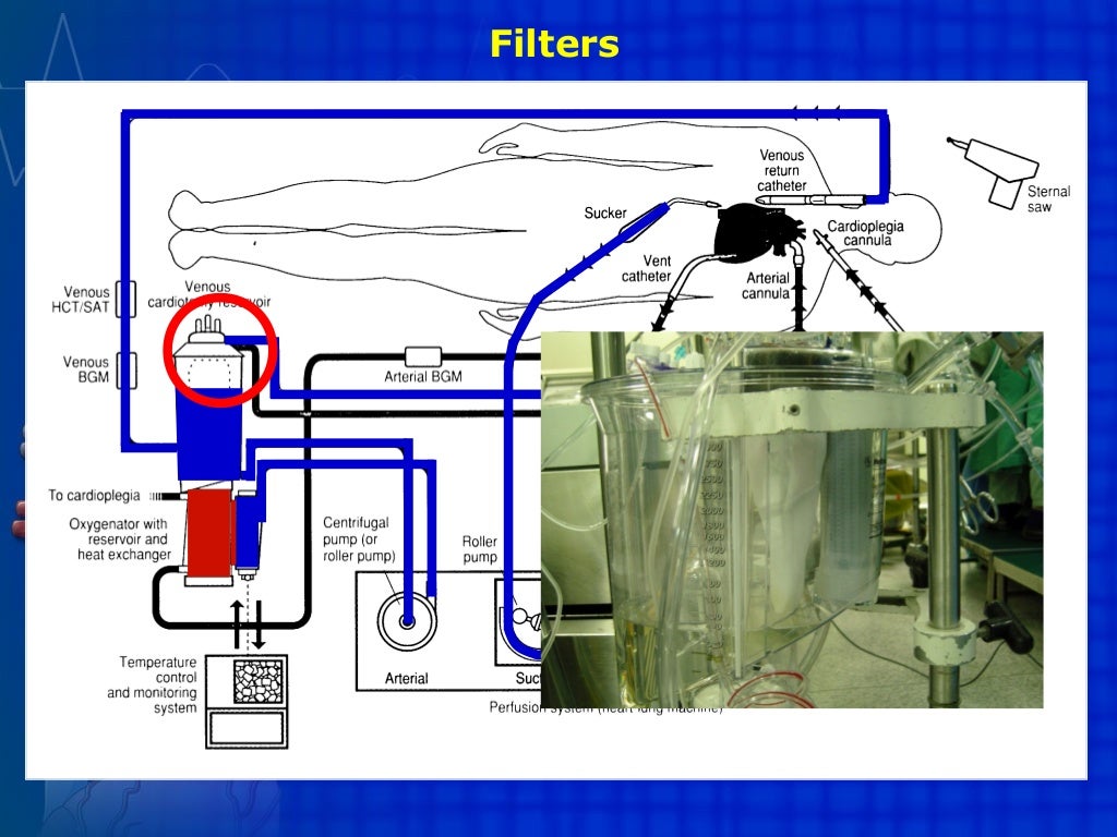 Extracorporeal circulation CPB, ECMO