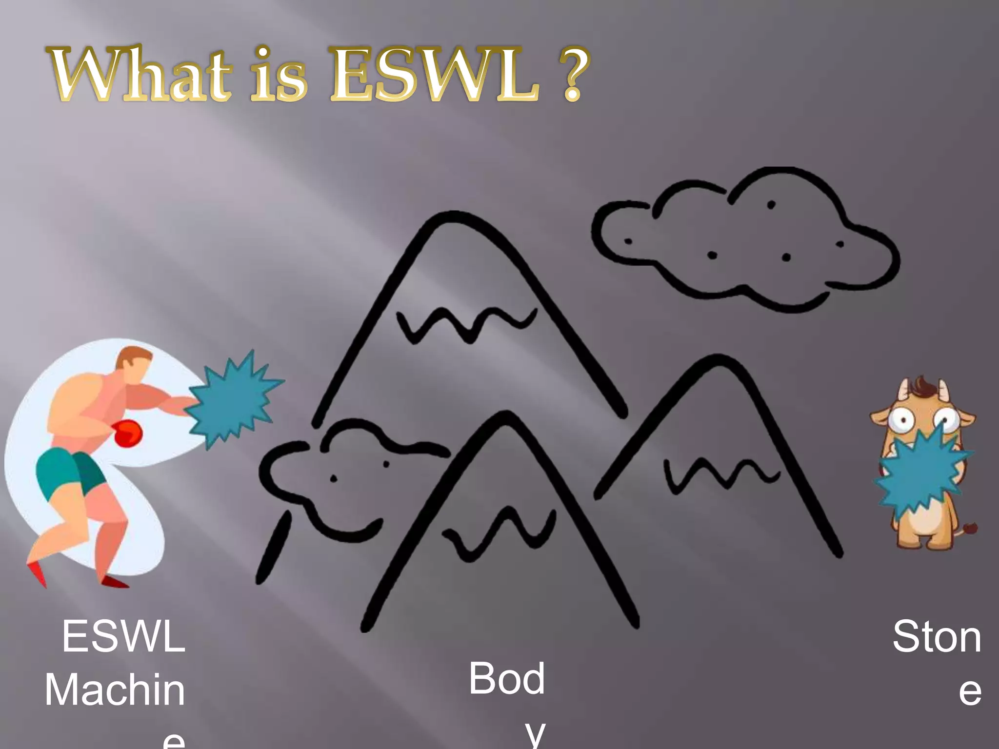 Extracorporeal shock wave lithotripsy (eswl) | PPTX