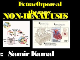 Extrac0rporeal
therapy
NON-RENALUSES
r: SamirKamal
 
