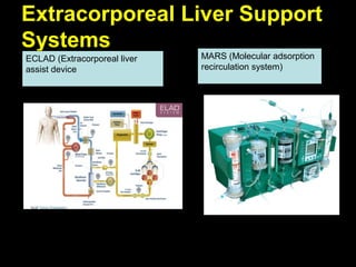 Extracorporeal Therapy - Dr. Samir kamal | PPT