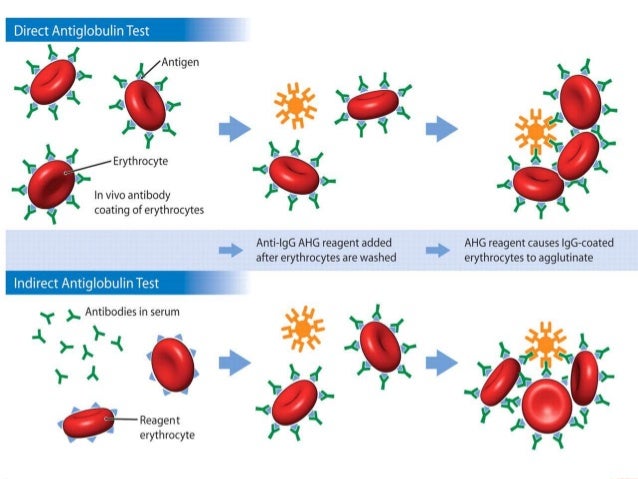 Extracorpuscular hemolytic anemia