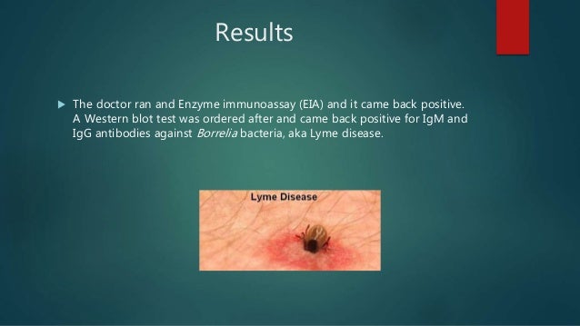 Lyme disease case study quizlet image