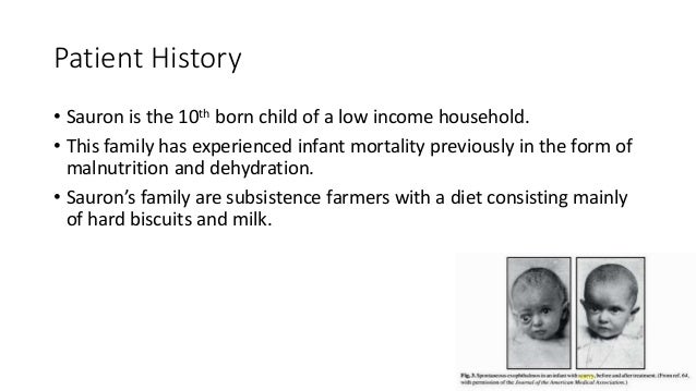Scurvy cases per year picture