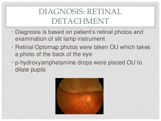 Retinal detachment case presentation ppt picture